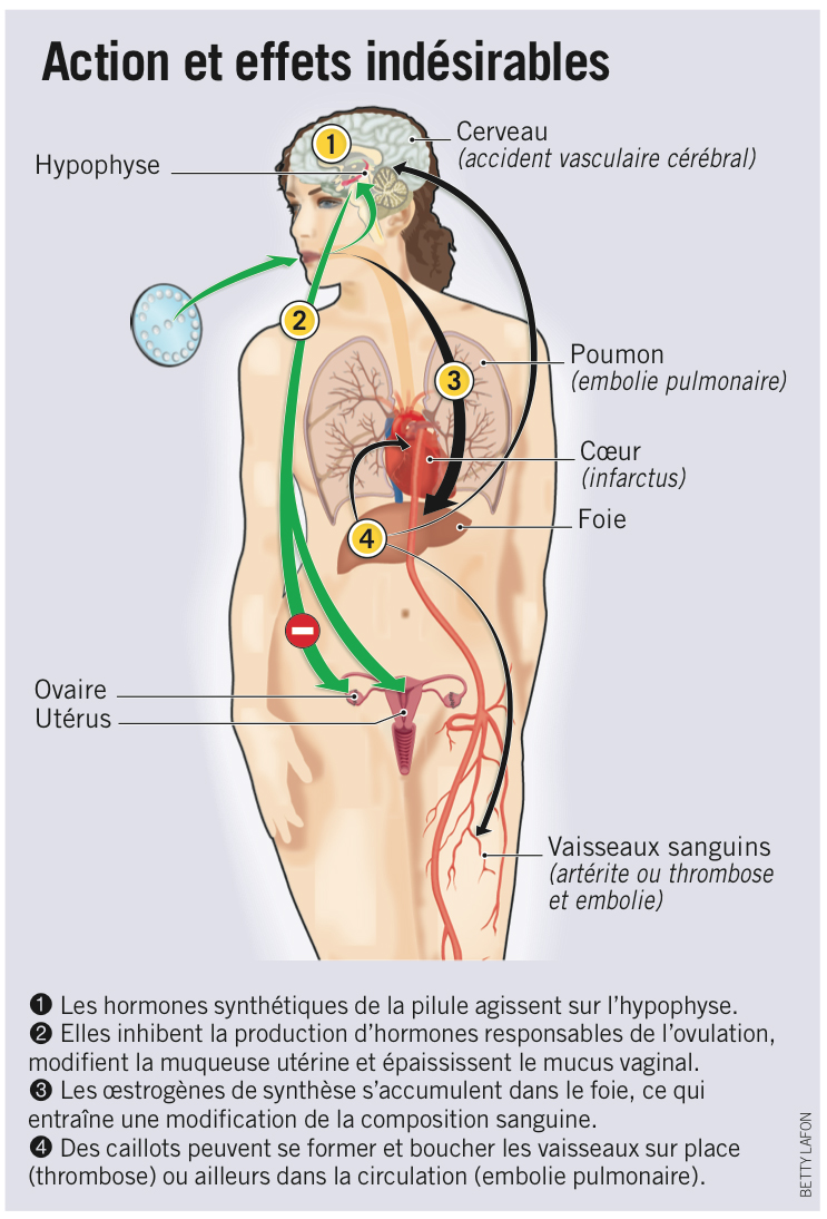 Dangers pilules contraceptives